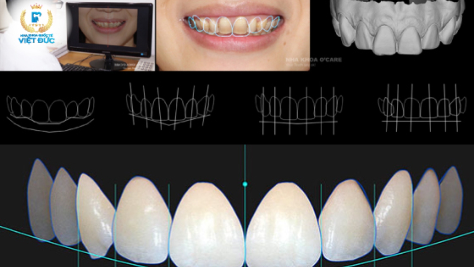 Công nghệ chẩn đoán hình ảnh & Thiết kế nụ cười