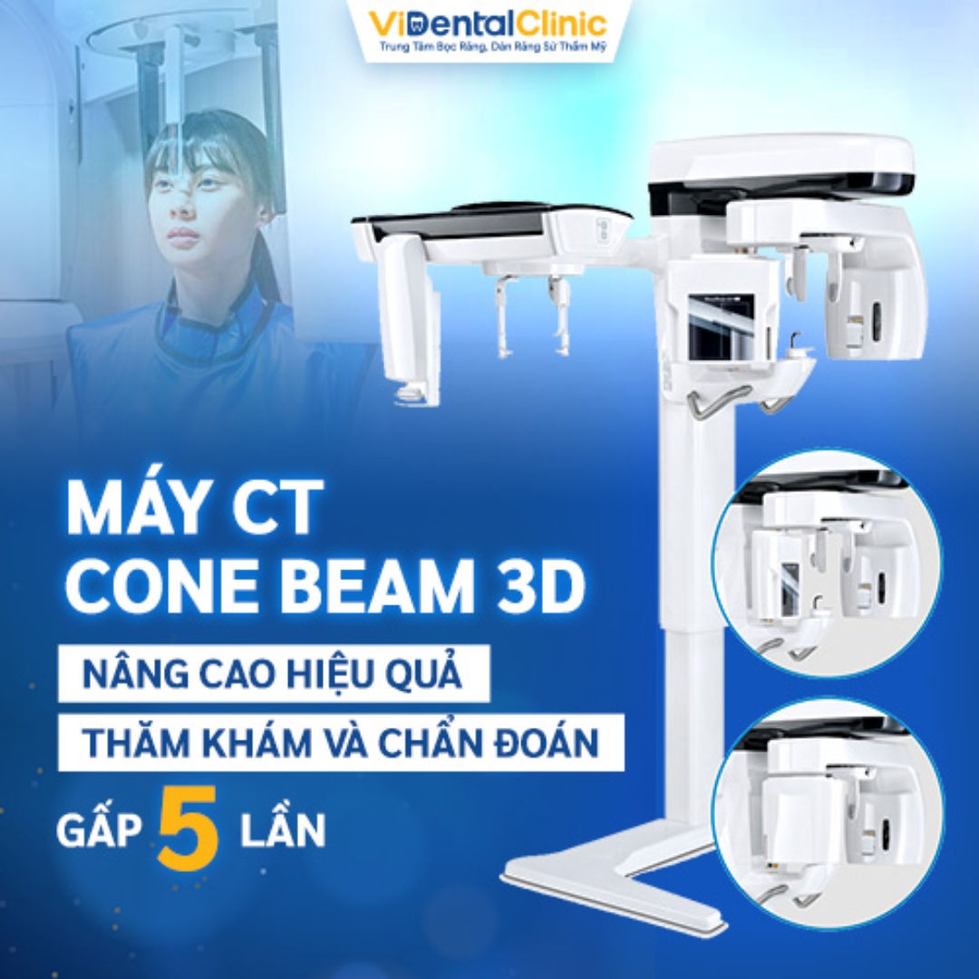 Máy CT Cone beam 3D