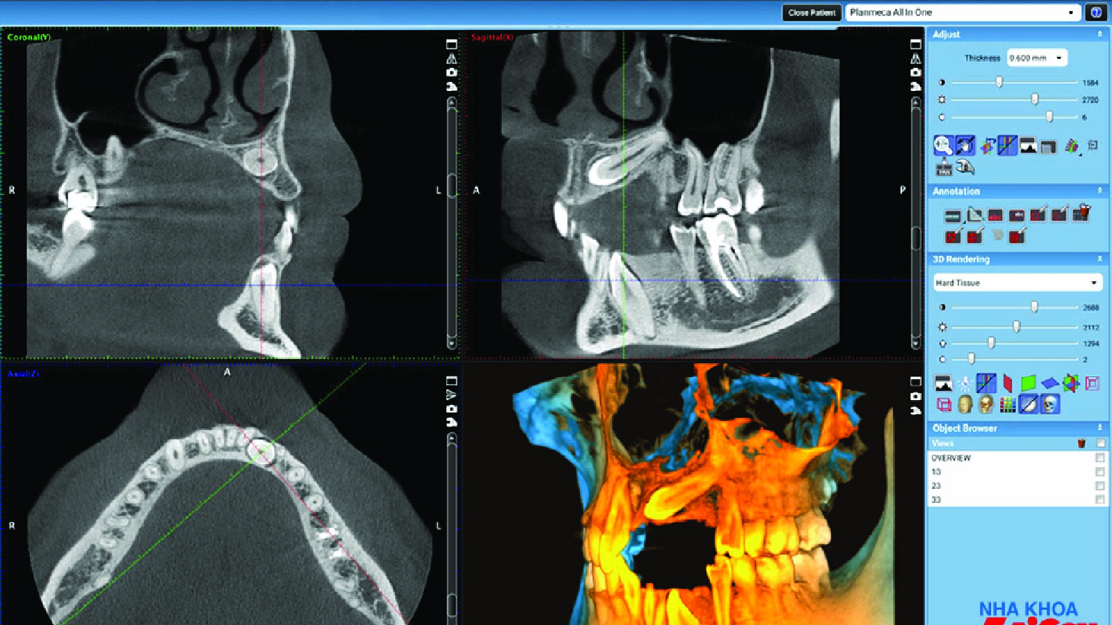 Planmeca 3D imaging software