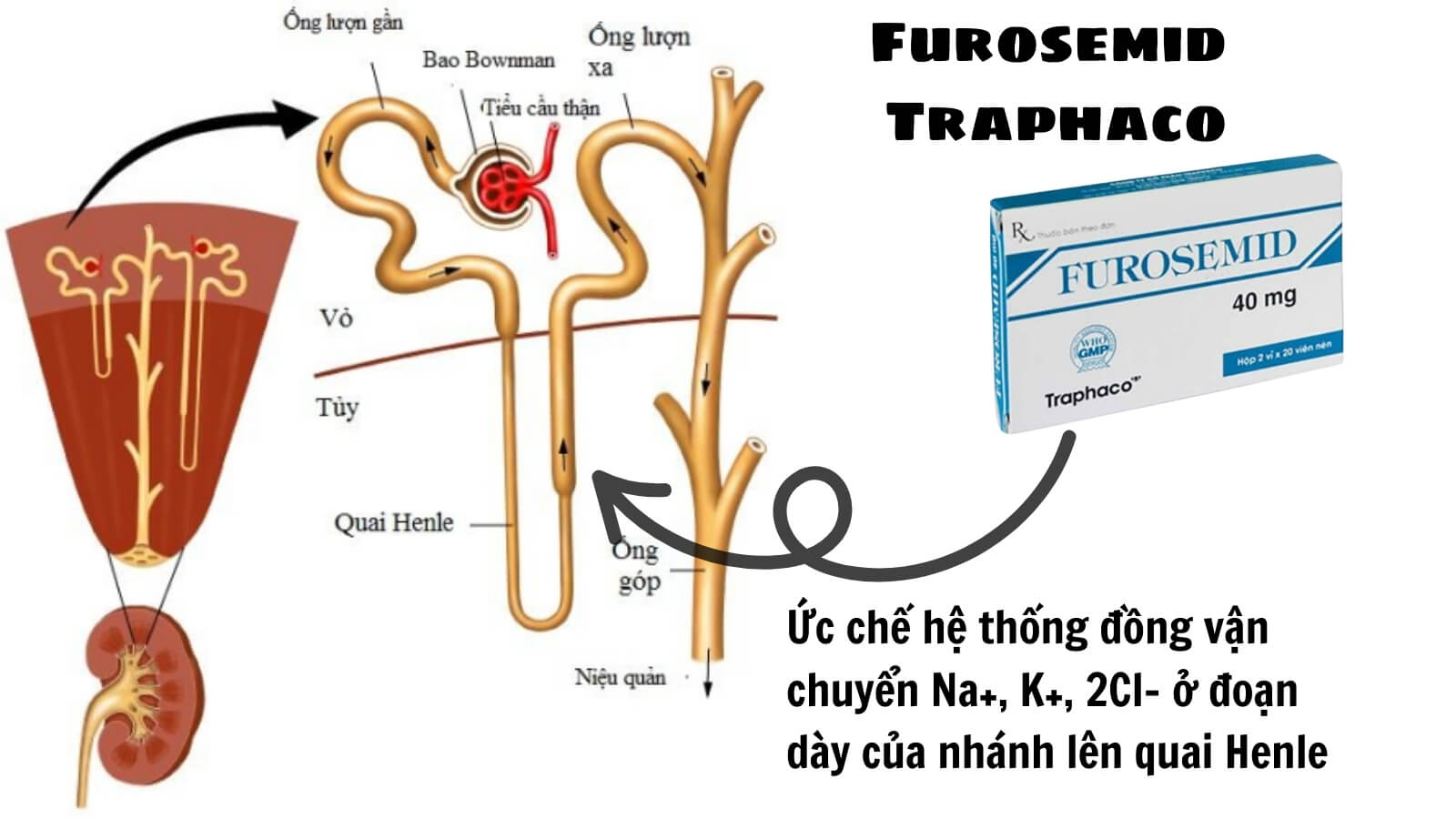 Furosemid Traphaco điều trị sỏi niệu - thận, bàng quang....