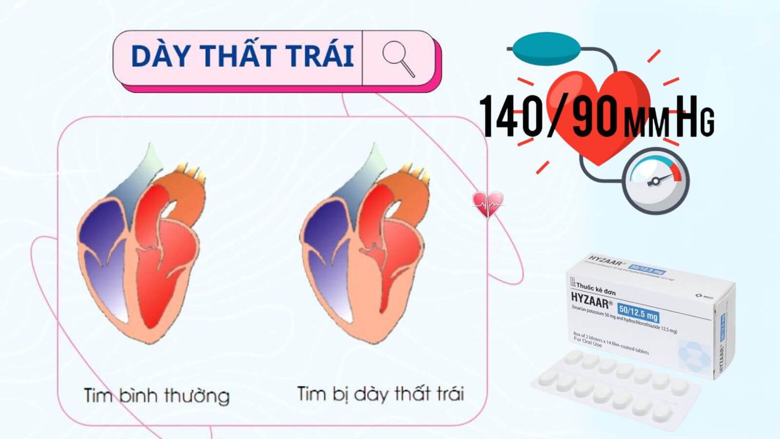 Hyzaar 50m/12.5mg giúp dự phòng biến cố tim mạch ở người tăng huyết áp bị phì đại tâm thất trái