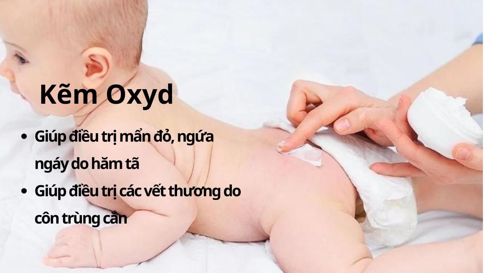 Phân tích tác dụng của kem oxyd cho kem hăm tã Sudocrem