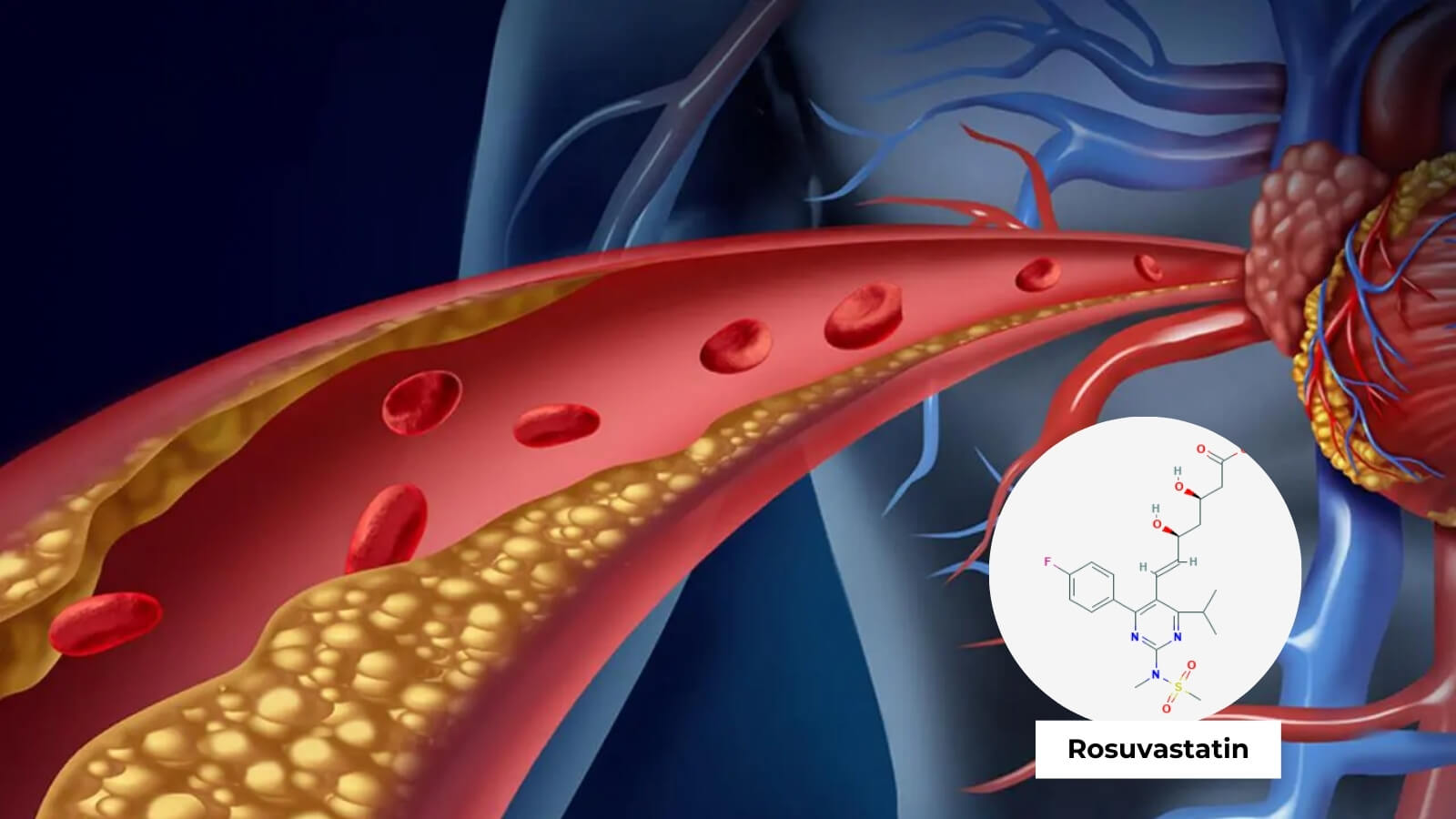 Rosuvastatin trong thuốc được sử dụng để giảm lượng cholesterol xấu trong máu