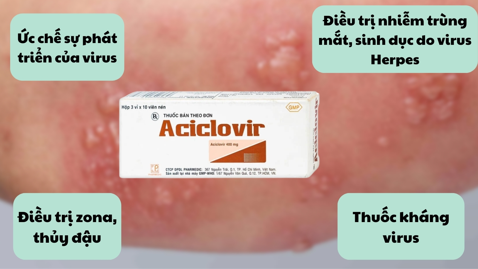 Công dụng của Acyclovir 400mg