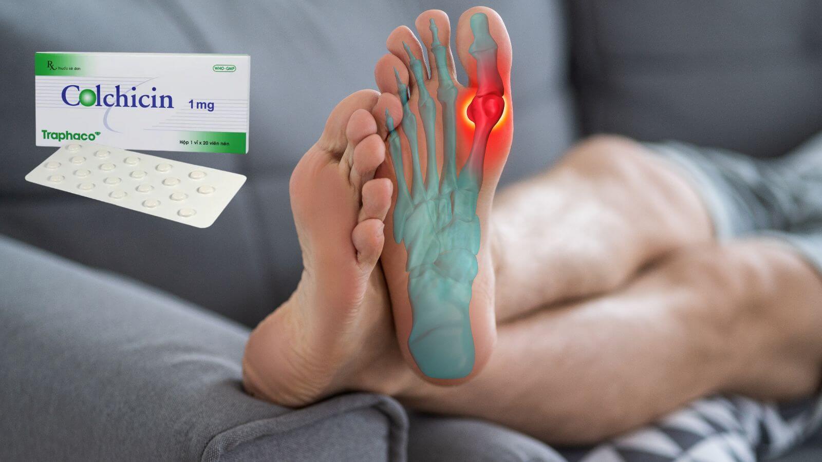 Colchicin Traphaco giúp điều trị và ngăn ngừa các đợt cấp của bệnh gout (gút) 