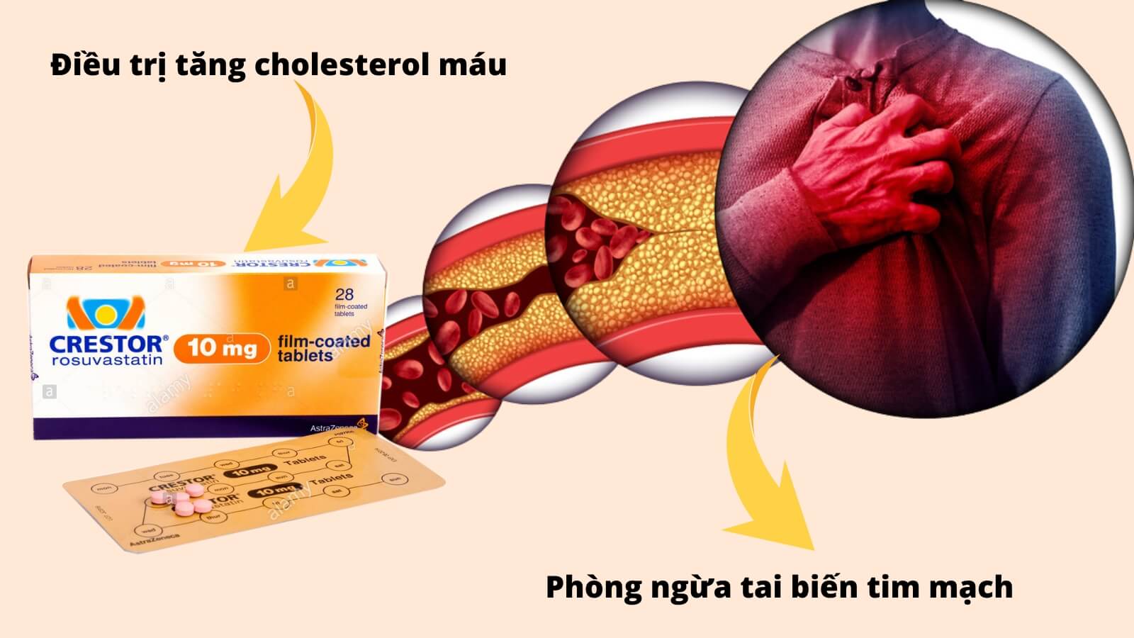 Crestor 10mg - Điều trị tăng cholesterol máu