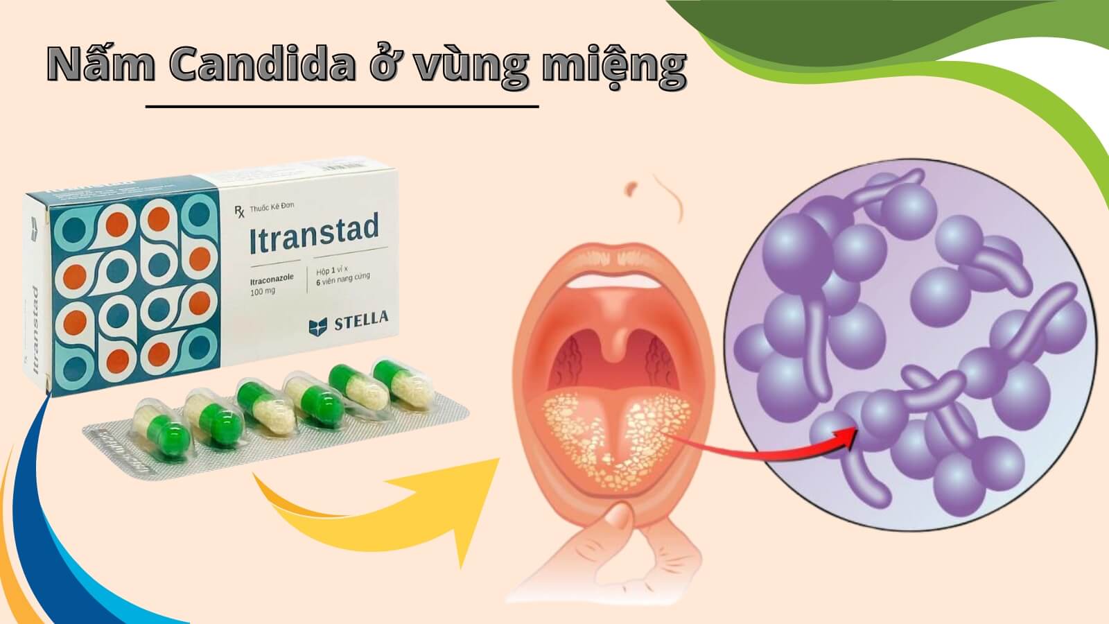 Itranstad - Điều trị nhiễm nấm Candida