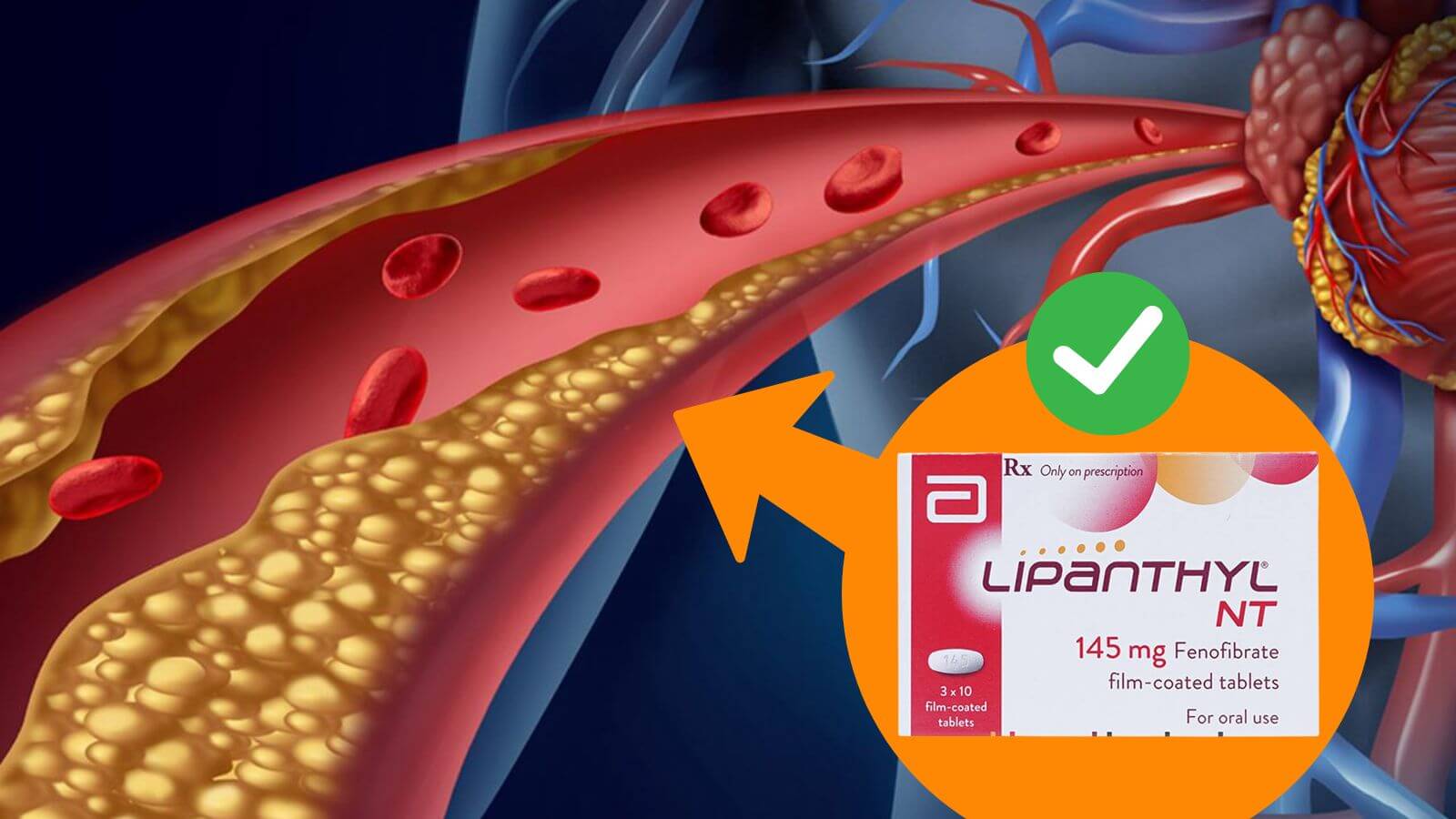 Lipanthyl 145 - Thuốc hạ lipid máu