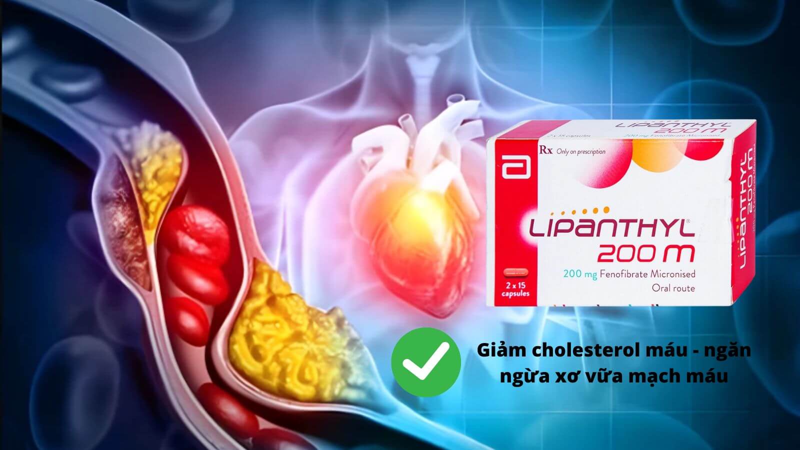 Lipanthyl 200 - Điều trị tăng cholesterol máu