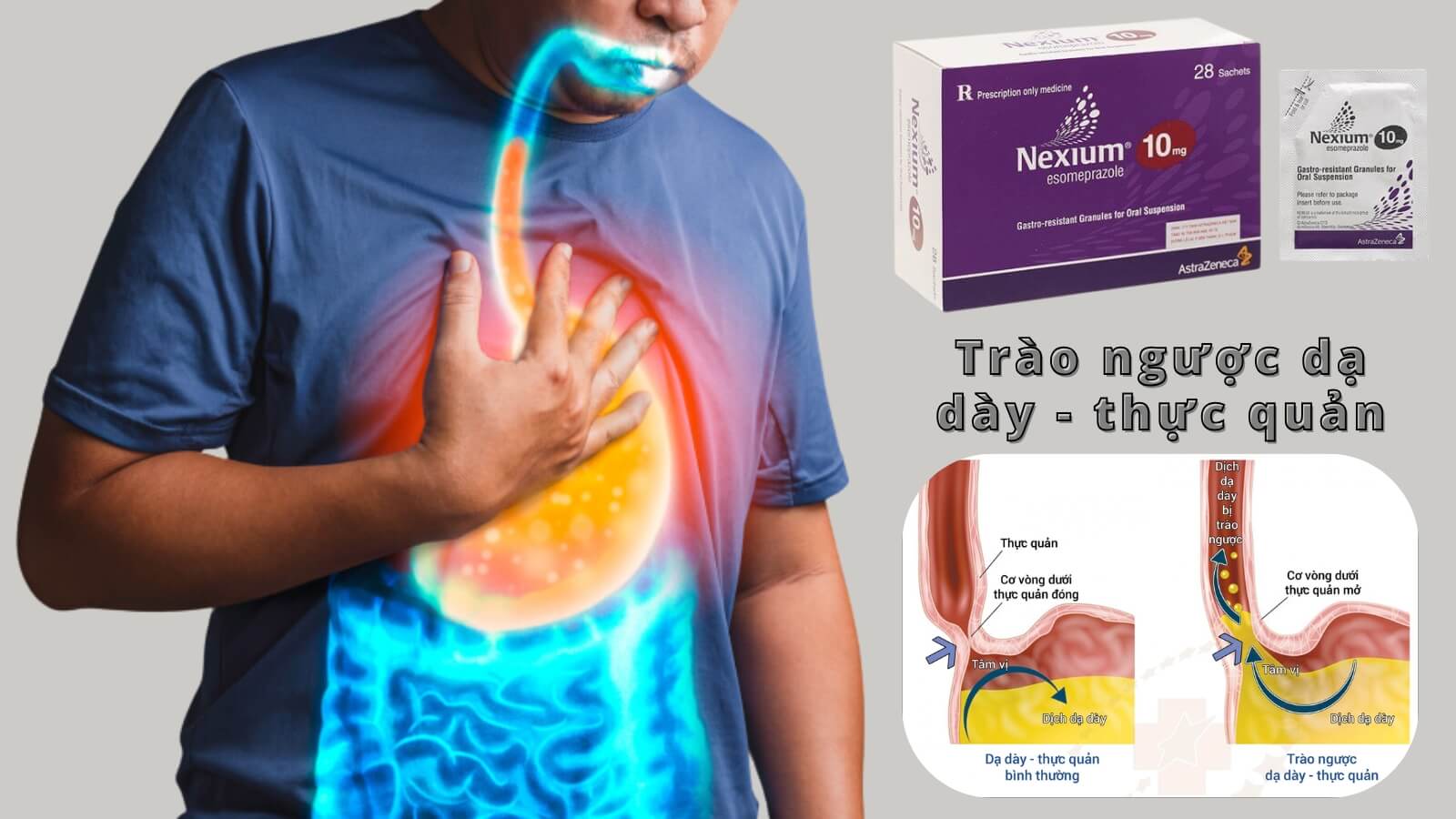 Nexium 10mg được chỉ định điều trị trào ngược dạ dày - thực quản