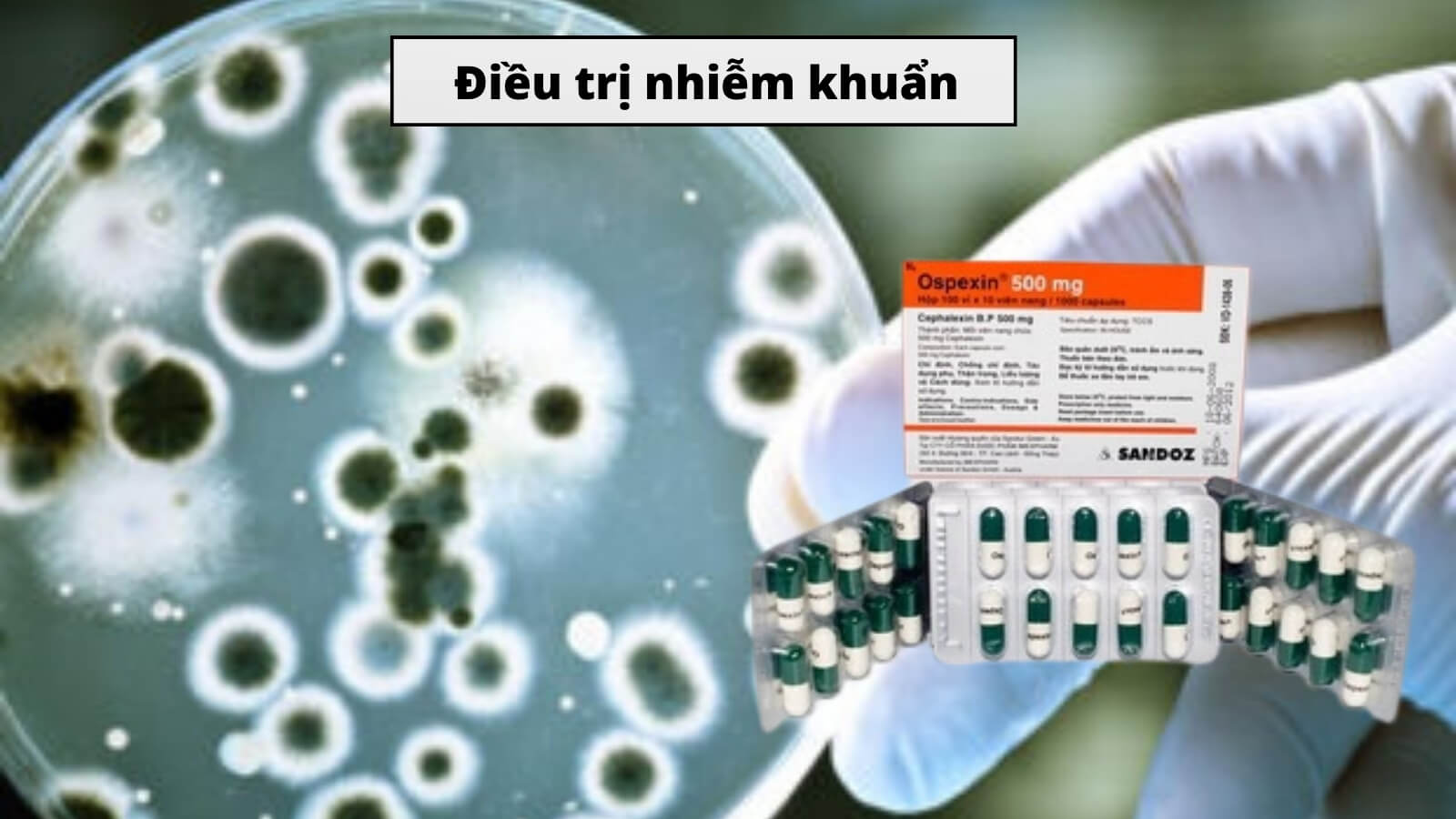 Cephalexin - Kháng sinh điều trị nhiễm khuẩn