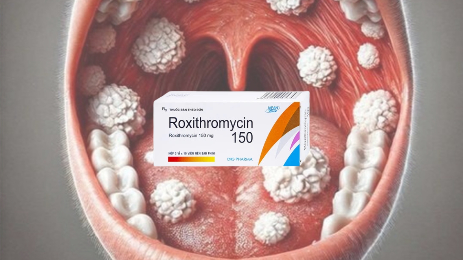 Roxithromycin - Khắc tinh của vi khuẩn gây ra bệnh bạch hầu