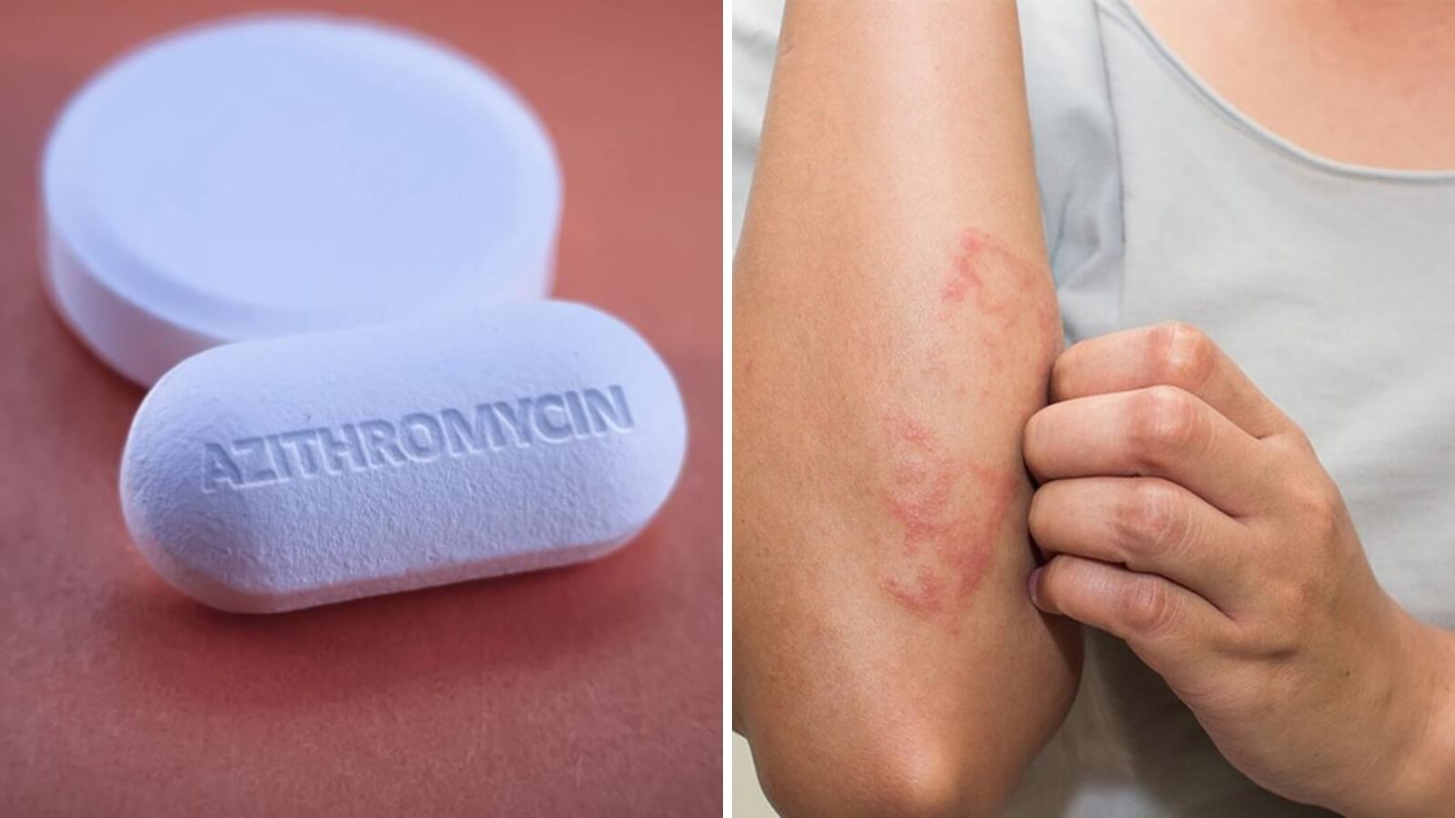 Azithromycin có trong thuốc là một loại kháng sinh có tác dụng chống lại vi khuẩn